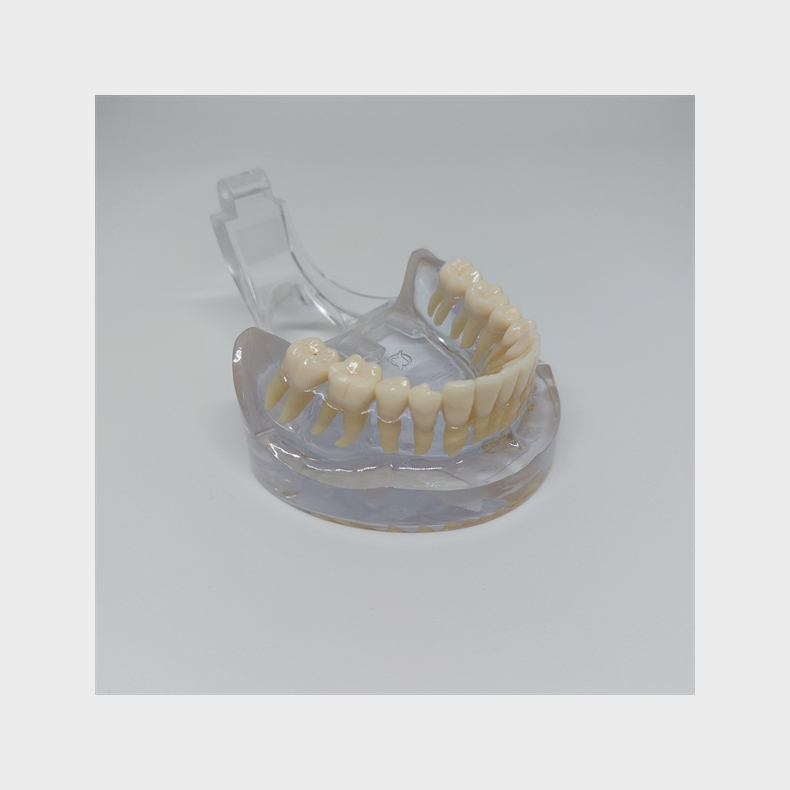 Transparent Kbemodel med Tnder 